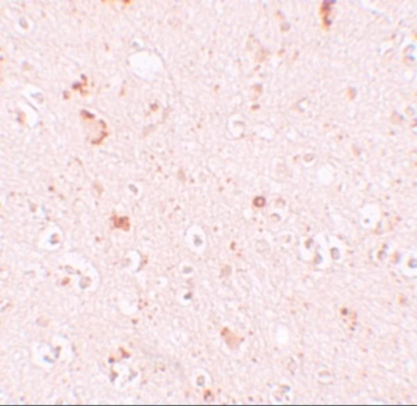 a11489 sh3rf2 primary antibodies ihc testing 2