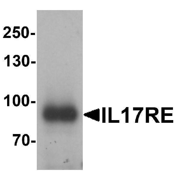 Western blot analysis of IL-17RE in human ovary tissue lysate with IL-17RE antibody at 1 μg/mL