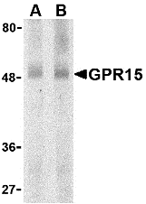 a11493 gpr15 primary antibodies wb testing 1