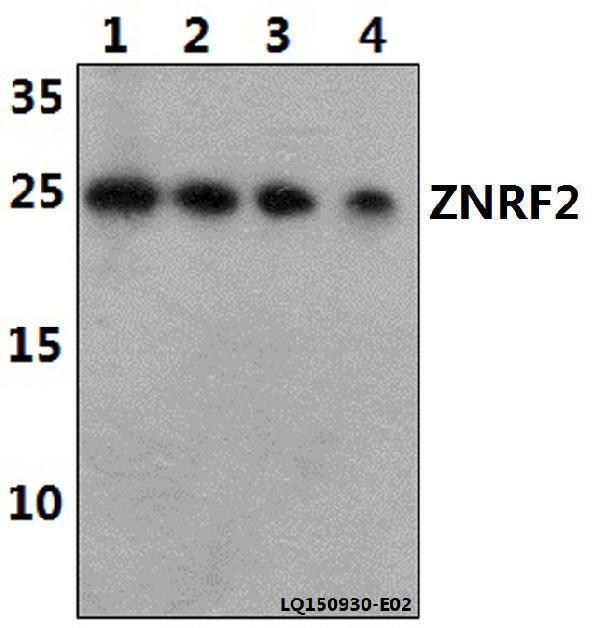Western blot (WB) analysis of TRAPPC6A polyclonal antibody at 1:500 dilution
Lane1:HEK293T whole cell lysate(40ug)
Lane2:H9C2 whole cell lysate(40ug)
Lane3:RAW264