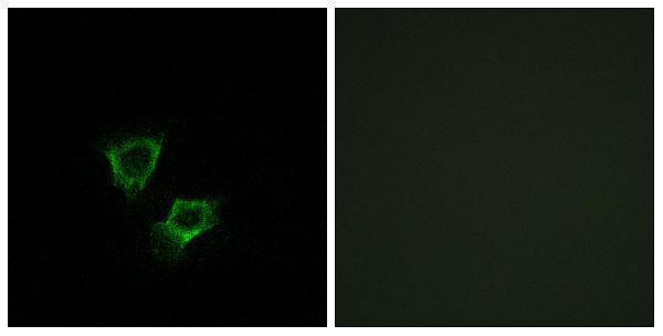 Immunofluorescence analysis of A549 cells, using ZNRF2 Antibody