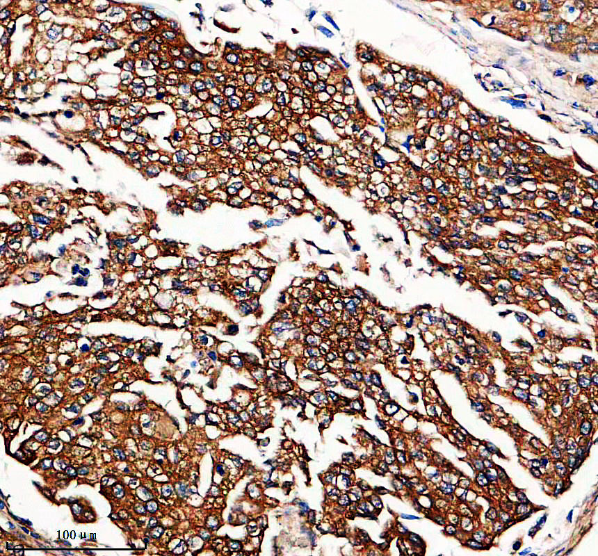 IHC analysis of MVB12A using anti-MVB12A antibody (A11506)