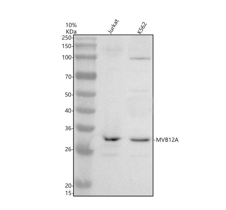 Western blot analysis of MVB12A using anti-MVB12A antibody (A11506)