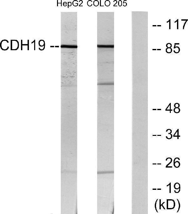 Western blot analysis of lysates from HepG2 and COLO205 cells, using CDH19 Antibody