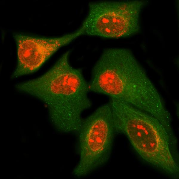 Figure 2. IF analysis of MPHOSPH10 using anti-MPHOSPH10 antibody (A11510-3) and anti-Beta Tubulin antibody (M01857-3). MPHOSPH10 was detected in immunocytochemical section of HELA cell. Enzyme antigen retrieval was performed using IHC enzyme antigen retrieval reagent (AR0022) for 15 mins. The cells were blocked with 10% goat serum. And then incubated with 5 microg/mL rabbit anti-MPHOSPH10 Antibody (A11510-3) and mouse anti-Beta Tubulin antibody (M01857-3) overnight at 4°C. Cy3 Conjugated Goat Anti-Rabbit IgG (BA1032) and DyLight®488 Conjugated Goat Anti-Mouse IgG (BA1126) were used as secondary antibody at 1:500 dilution and incubated for 30 minutes at 37°C. Visualize using a fluorescence microscope and filter sets appropriate for the label used.