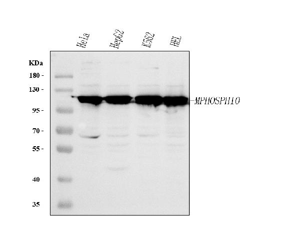 Figure 1. Western blot analysis of MPHOSPH10 using anti-MPHOSPH10 antibody (A11510-3). Electrophoresis was performed on a 5-20% SDS-PAGE gel at 70V (Stacking gel) / 90V (Resolving gel) for 2-3 hours. The sample well of each lane was loaded with 30 ug of sample under reducing conditions. Lane 1: human Hela whole cell lysates, Lane 2: human HepG2 whole cell lysates, Lane 3: human K562 whole cell lysates, Lane 4: human HEL whole cell lysates. After electrophoresis, proteins were transferred to a nitrocellulose membrane at 150 mA for 50-90 minutes. Blocked the membrane with 5% non-fat milk/TBS for 1.5 hour at RT. The membrane was incubated with rabbit anti-MPHOSPH10 antigen affinity purified polyclonal antibody (Catalog # A11510-3) at 0.25 microg/mL overnight at 4°C, then washed with TBS-0.1%Tween 3 times with 5 minutes each and probed with a goat anti-rabbit IgG-HRP secondary antibody at a dilution of 1:5000 for 1.5 hour at RT. The signal is developed using an Enhanced Chemiluminescent detection (ECL) kit (Catalog # EK1002) with Tanon 5200 system. A specific band was detected for MPHOSPH10 at approximately 120 kDa. The expected band size for MPHOSPH10 is at 120 kDa.