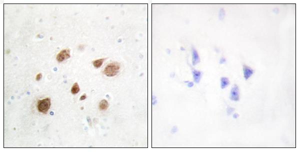 a11515 pnck primary antibodies ihc testing 1