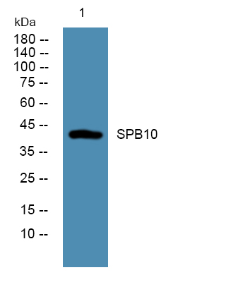 Western blot analysis of lysates from SH-SY5Y cells, primary antibody was diluted at 1:1000, 4°over night
