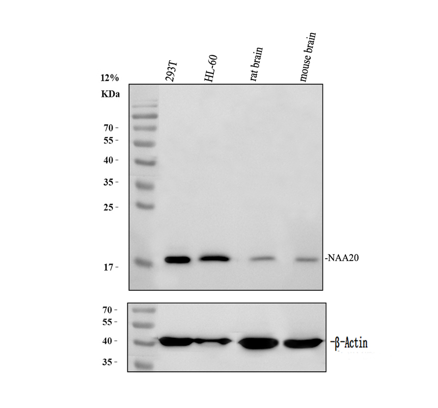 a11521 1 naa20 primary antibodies wb testing 1