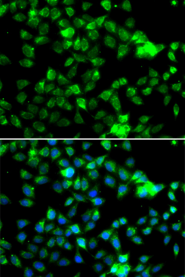 Immunohistochemistry of paraffin-embedded rat kidney using NAA20 antibody  at dilution of 1:100 