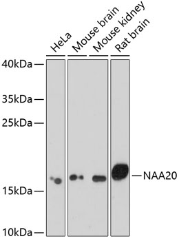 Western blot analysis of extracts of various cell lines, using NAA20 antibody  at 1:1000 dilution