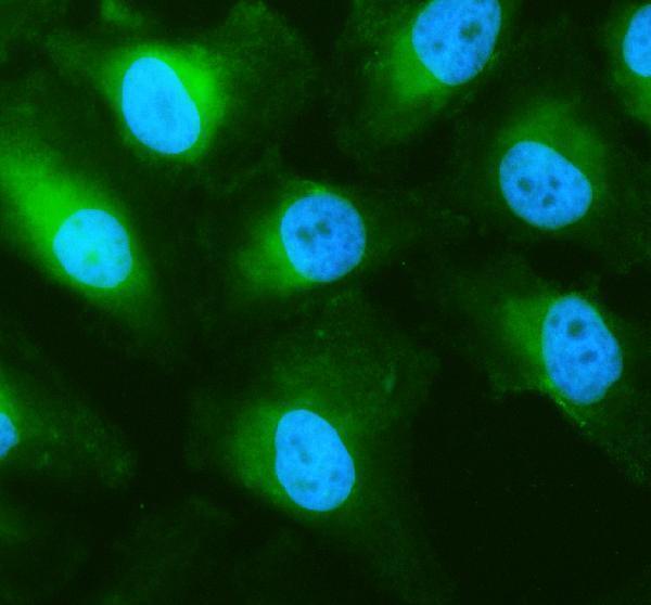 a11524 1 sfxn1 primary antibodies if testing 1
