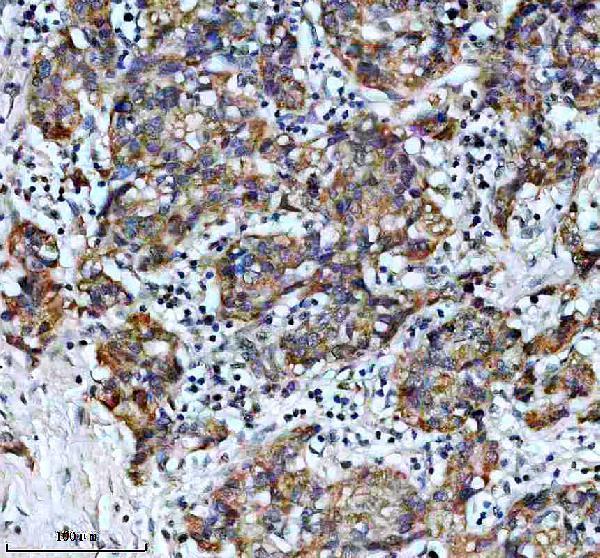 IHC analysis of SFXN1 using anti-SFXN1 antibody (A11524-1)