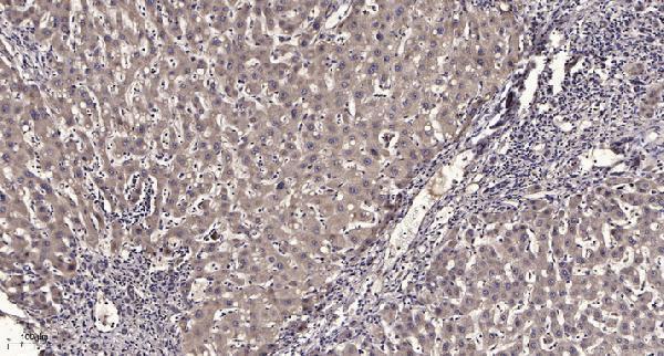 a11525 2 necab3 primary antibodies ihc testing 4