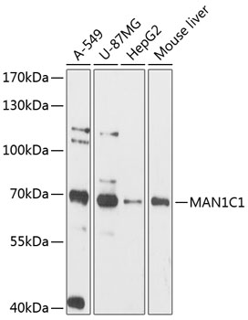 a11526 man1c1 primary antiboties wb testing 1