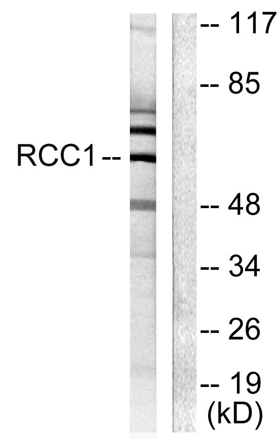 a11528 rcbtb1 primary antibodies wb testing 2