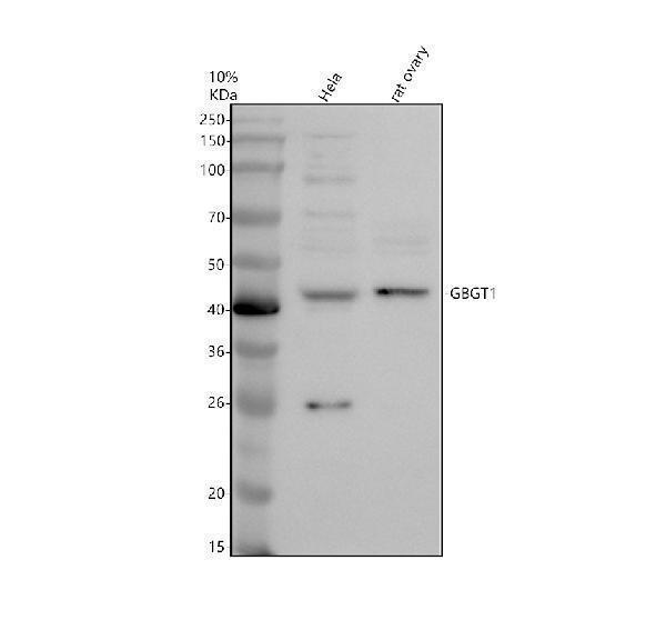 Western blot analysis of GBGT1 using anti-GBGT1 antibody (A11531)