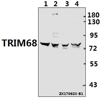Western blot (WB) analysis of TRIM68 polyclonal antibody at 1:500 dilution
Lane1:CT26 whole cell lysate(40ug)
Lane2:C6 whole cell lysate(40ug)
Lane3:HEK293T whole cell lysate(40ug)
Lane4:A549 whole cell lysate(40ug)
