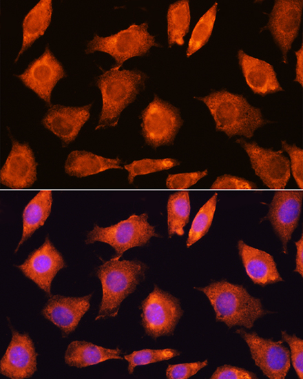 a11535 sec11a primary antiboties if testing 2