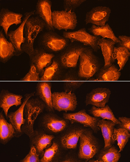 a11535 sec11a primary antiboties if testing 3