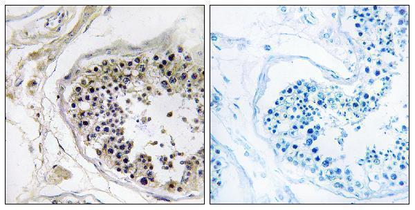 a11538 1 cst8 primary antibodies ihc testing 1