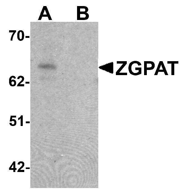 a11540 zgpat primary antibodies wb testing 1