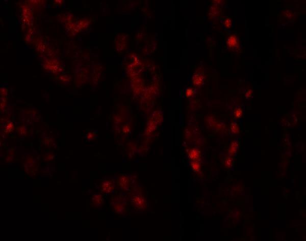 Immunofluorescence of DISP1 in human kidney tissue with DISP1 antibody at 20 μg/mL