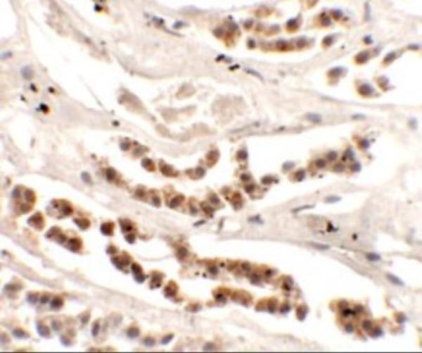 Immunohistochemistry of DISP1 in human kidney tissue with DISP1 antibody at 2