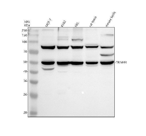 Western blot analysis of TRIM44 using anti-TRIM44 antibody (A11544-1)