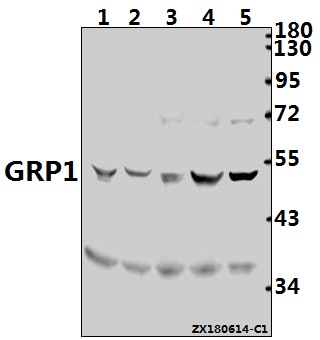 Western blot (WB) analysis of GRP1 (K400) pAb at 1:2000 dilution
Lane1:3T3-L1 whole cell lysate(40ug)
Lane2:H9C2 whole cell lysate(40ug)
Lane3:A2780 whole cell lysate(40ug)
Lane4:H1792 whole cell lysate(40ug)
Lane5:A375 whole cell lysate(20ug)
