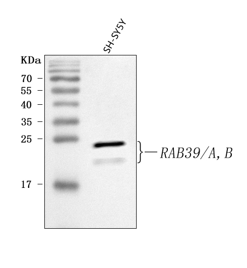 Figure 1. Western blot analysis of RAB39A/B using anti-RAB39A/B antibody (A11551-1). Electrophoresis was performed on a 5-20% SDS-PAGE gel at 70V (Stacking gel) / 90V (Resolving gel) for 2-3 hours. The sample well of each lane was loaded with 30 ug of sample under reducing conditions. Lane 1: human SH-SY5Y whole cell lysates. After electrophoresis, proteins were transferred to a nitrocellulose membrane at 150 mA for 50-90 minutes. Blocked the membrane with 5% non-fat milk/TBS for 1.5 hour at RT. The membrane was incubated with rabbit anti-RAB39A/B antigen affinity purified polyclonal antibody (Catalog # A11551-1) at 0.5 microg/mL overnight at 4°C, then washed with TBS-0.1%Tween 3 times with 5 minutes each and probed with a goat anti-rabbit IgG-HRP secondary antibody at a dilution of 1:5000 for 1.5 hour at RT. The signal is developed using an Enhanced Chemiluminescent detection (ECL) kit (Catalog # EK1002) with Tanon 5200 system. A specific band was detected for RAB39A/B at approximately 20-24 kDa. The expected band size for RAB39A/B is at 25 kDa.