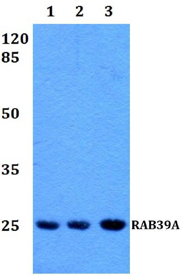 a11551 rab39a primary antiboties wb testing 1
