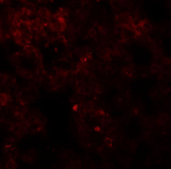 Immunofluorescence of Coronin 7 in rat lung tissue with Coronin 7 antibody at 20 μg/mL