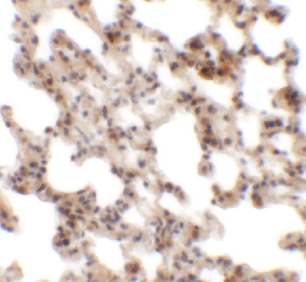 Immunohistochemistry of Coronin 7 in rat lung tissue with Coronin 7 antibody at 2