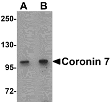 Western blot analysis of Coronin 7 in rat lung tissue lysate with Coronin 7 antibody at (A) 1 and (B) 2 μg/mL