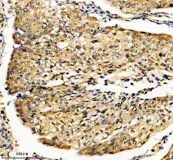 a11553 1 armc8 primary antibodies ihc testing 1