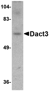 Western blot analysis of Dact3 in rat brain tissue lysate with Dact3 antibody at 1 μg/mL