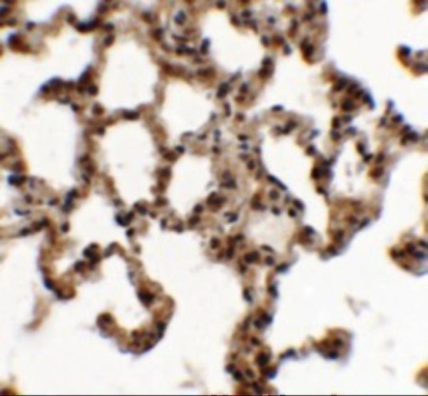 a11563 spink7 primary antibodies ihc testing 2