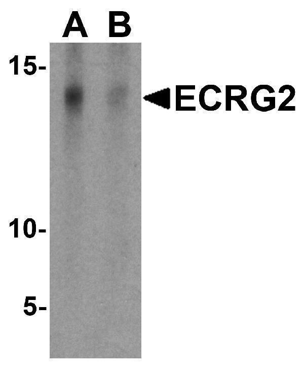 a11563 spink7 primary antibodies wb testing 1