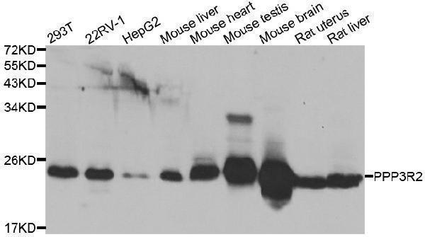 Western blot analysis of extracts of various cell lines, using PPP3R2 antibody