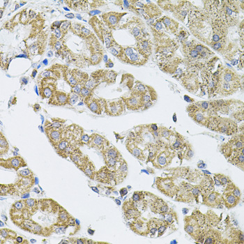 Western blot analysis of extracts of Mouse brain, using VEPH1 antibody  at 1:1000 dilution