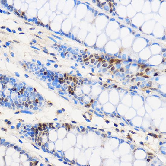 a11578 znf263 primary antiboties ihc testing 2