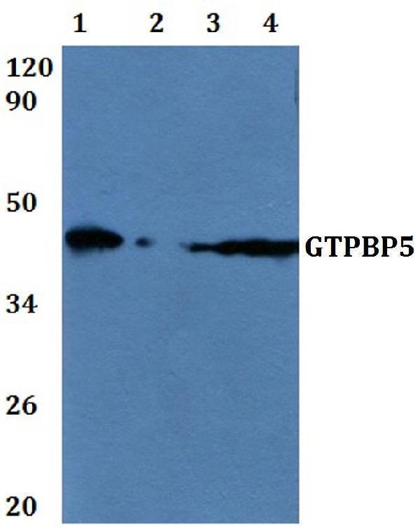 Western blot (WB) analysis of GTPBP5 polyclonal antibody at 1:500 dilution 
Line1:A549 whole cell lysate
Line2:Hela whole cell lysate
Line3:PC12 whole cell lysate
Line4:sp20 whole cell lysate