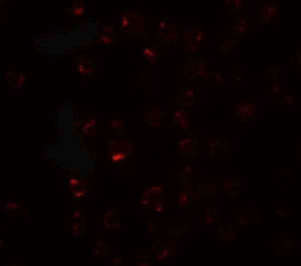 Immunofluorescence of CLEC2A in K562 cells with CLEC2A antibody at 20 μg/mL