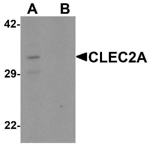 Western blot analysis of CLEC2A in K562 cell lysate with CLEC2A antibody at 1 μg/ml in (A) the absence and (B) the presence of blocking peptide