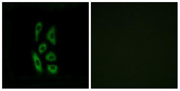 Immunofluorescence analysis of A549 cells, using ACOT12 Antibody