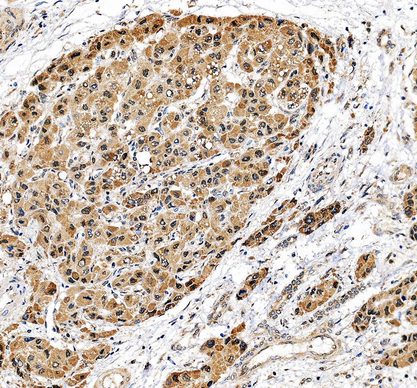 IHC analysis of IPO4 using anti-IPO4 antibody (A11591-1)