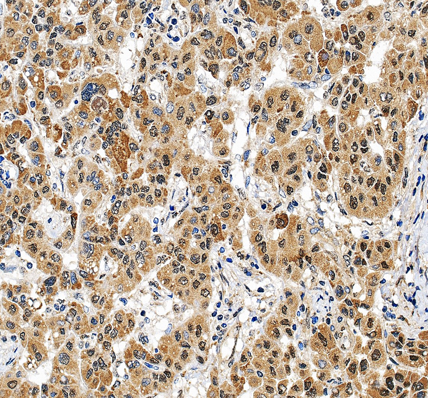 IHC analysis of IPO4 using anti-IPO4 antibody (A11591-1)