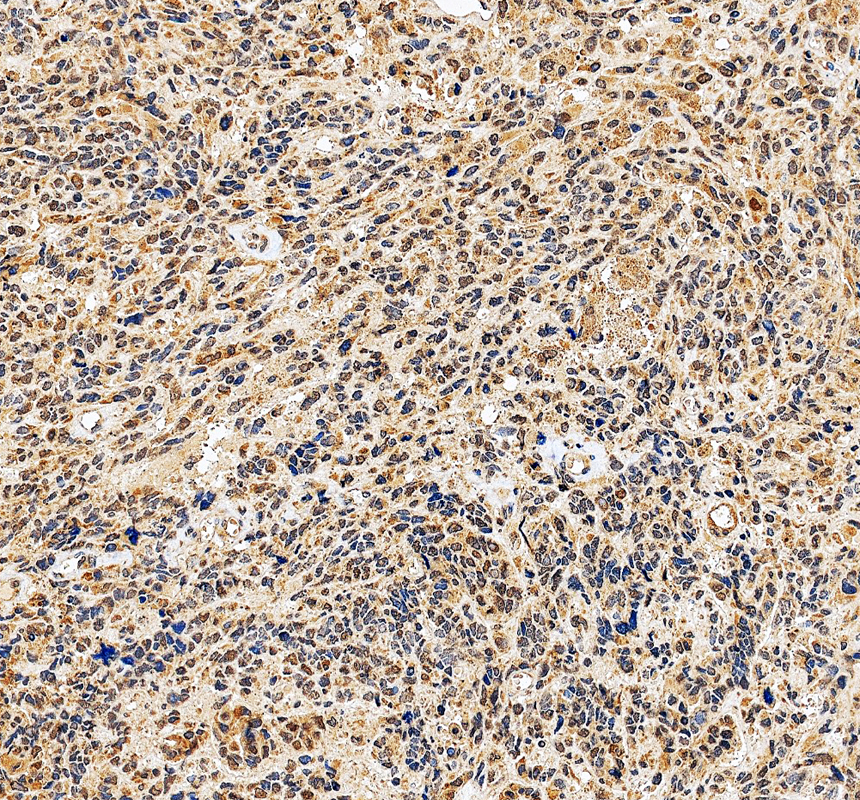 a11591 1 ipo4 primary antibodies ihc testing 3