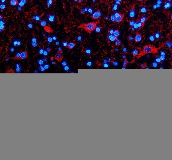 a11593 1 timm10 primary antibodies if testing 1